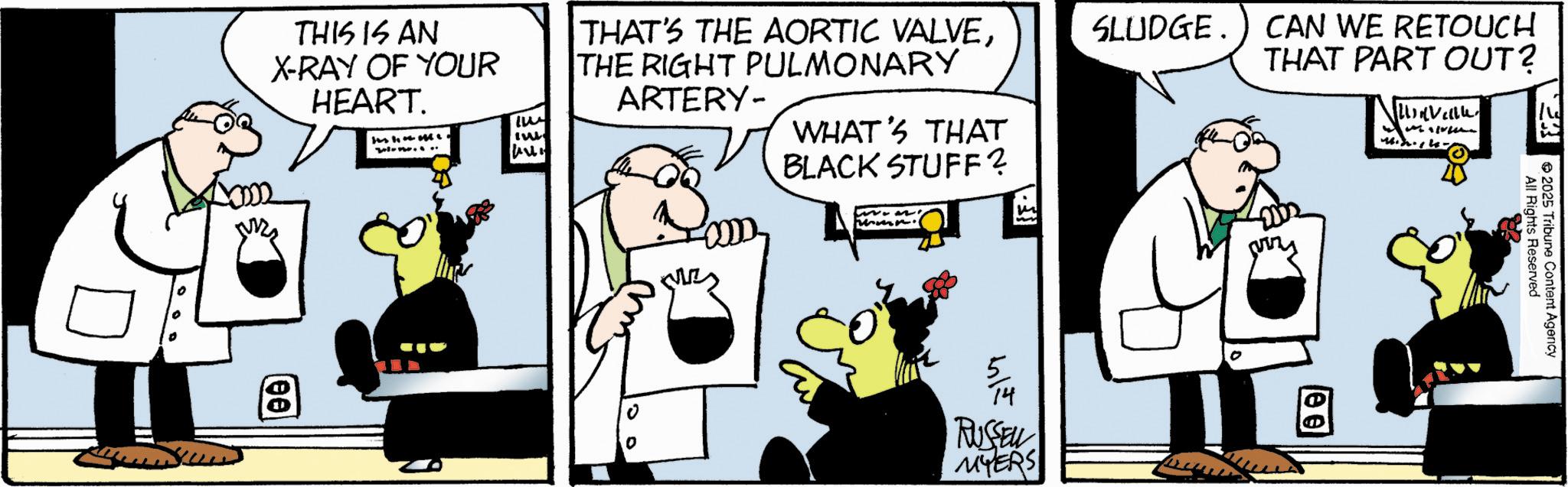 Animated cartoon OCR: THIS IS AN X-RAY OF YOUR HEART. (00) 11:06 06 IW T THAT'S THE AORTIC VALVETHE RIGHT PULMONARY ARTERY- WHAT'S THAT BLACK STUFF? S? .. SLUDGE. CAN WE RETOUCH THAT PART OUT? 5/M RUSSELL MYERS All Rights Reserved 2025 Tribune Content Agency THIS IS AN X - RAY OF YOUR HEART . ( 00 ) 11:06 06 IW T THAT'S THE AORTIC VALVETHE RIGHT PULMONARY ARTERY- WHAT'S THAT BLACK STUFF ? S ? .. SLUDGE . CAN WE RETOUCH THAT PART OUT ? 5 / M RUSSELL MYERS All Rights Reserved 2025 Tribune Content Agency